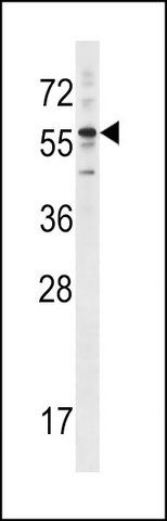 ANTI-KRT3 (CENTER) antibody produced in rabbit