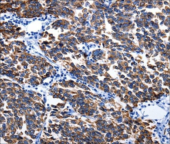 Anti-KRT6A antibody produced in rabbit