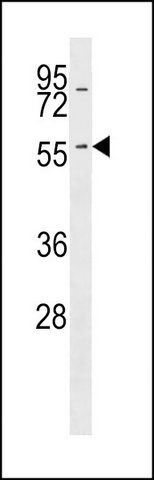 ANTI-KRT6A (N-TERM) antibody produced in rabbit