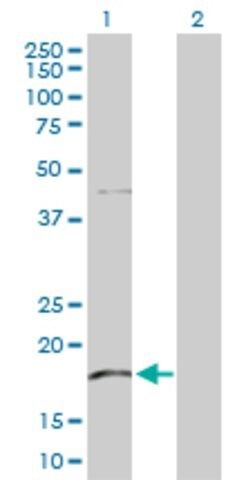 Anti-KLRG1 antibody produced in rabbit