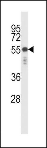 ANTI-KRT6C (N-TERM) antibody produced in rabbit