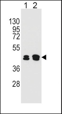 ANTI-KRT80 (C-TERM) antibody produced in rabbit