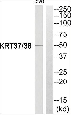 Anti-KRT37/38 antibody produced in rabbit