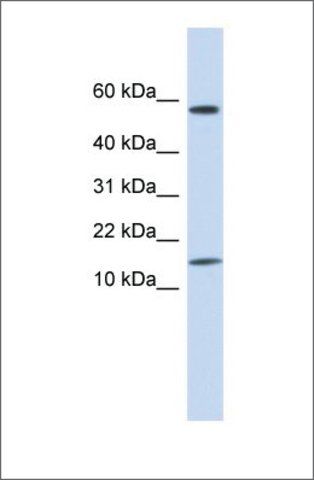 Anti-KRTAP11-1 antibody produced in rabbit