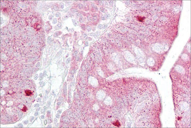 Anti-KRT8 (AB2) antibody produced in rabbit