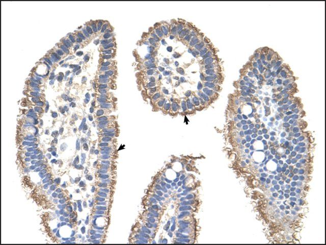 Anti-KRT2A antibody produced in rabbit