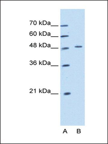 Anti-KRT20 antibody produced in rabbit