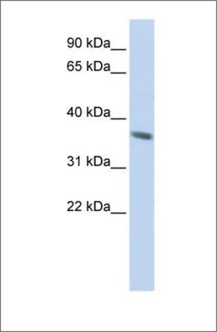 Anti-KRT222P antibody produced in rabbit