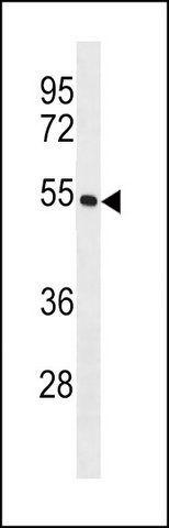 ANTI-KRT26 (N-TERM) antibody produced in rabbit