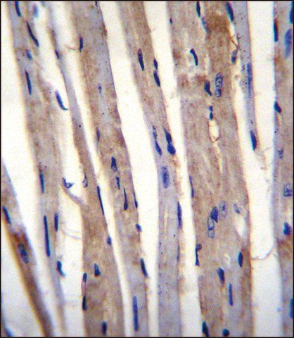 ANTI-KRT73 (C-TERM) antibody produced in rabbit