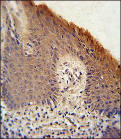 ANTI-KRTAP1-1 (CENTER) antibody produced in rabbit