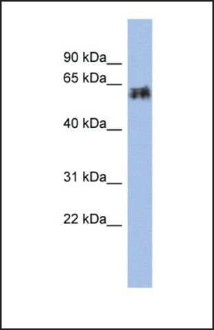 Anti-KRT75 antibody produced in rabbit
