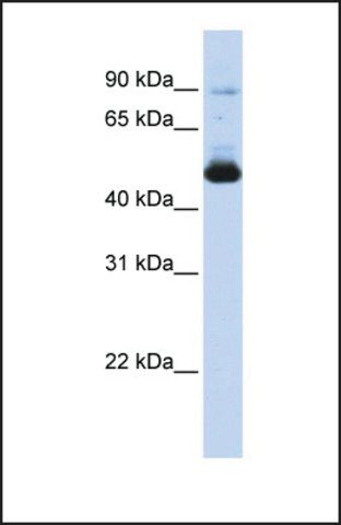 Anti-KRT16 antibody produced in rabbit