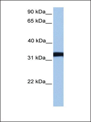 Anti-LDHC antibody produced in rabbit