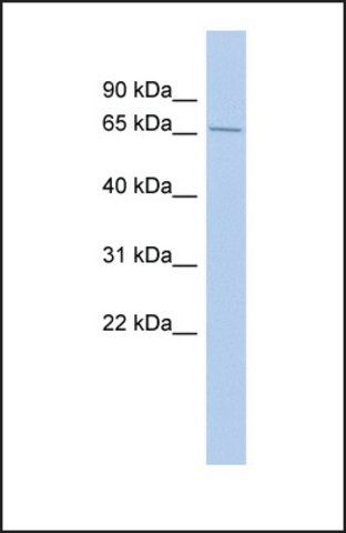 Anti-LARP4 antibody produced in rabbit