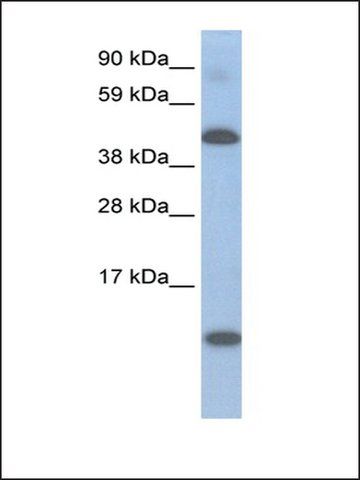 Anti-LCOR antibody produced in rabbit