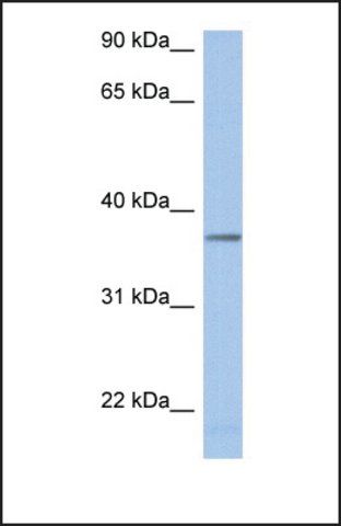 Anti-LDHAL6B antibody produced in rabbit