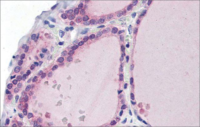 Anti-LDOC1 antibody produced in rabbit