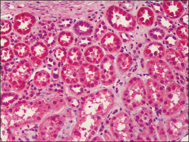 Anti-LGI3 antibody produced in rabbit