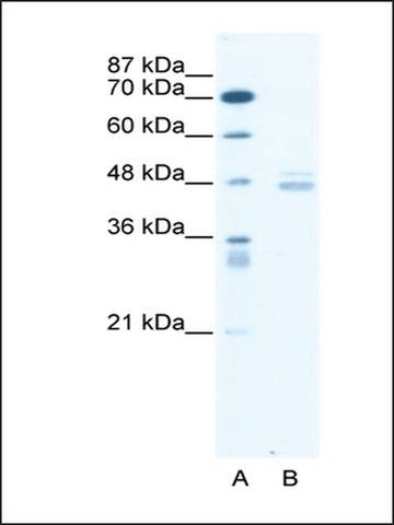 Anti-LDB1 (AB1) antibody produced in rabbit