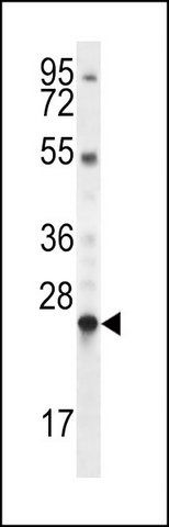 ANTI-LHFPL1 (N-TERM) antibody produced in rabbit
