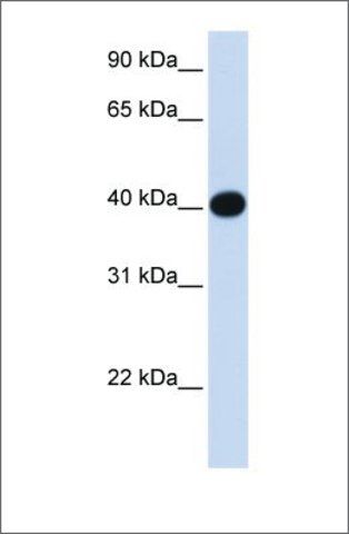 Anti-LIAS antibody produced in rabbit