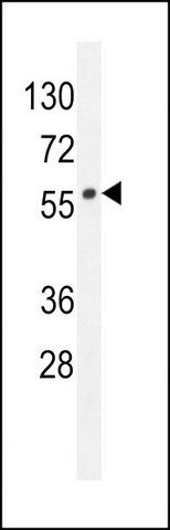 ANTI-LIPC (N-TERM) antibody produced in rabbit