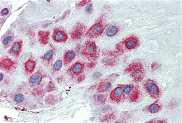 Anti-LIMD1 antibody produced in rabbit