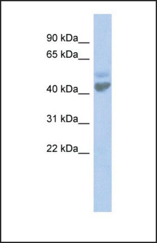 Anti-LGICZ1, (N-terminal) antibody produced in rabbit