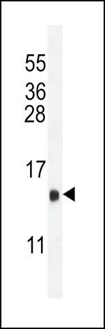 ANTI-LHB(C-TERMINAL) antibody produced in rabbit
