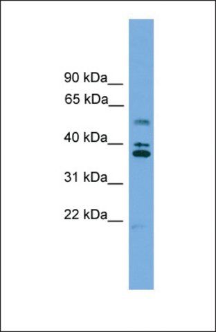 Anti-LDLRAD3 antibody produced in rabbit