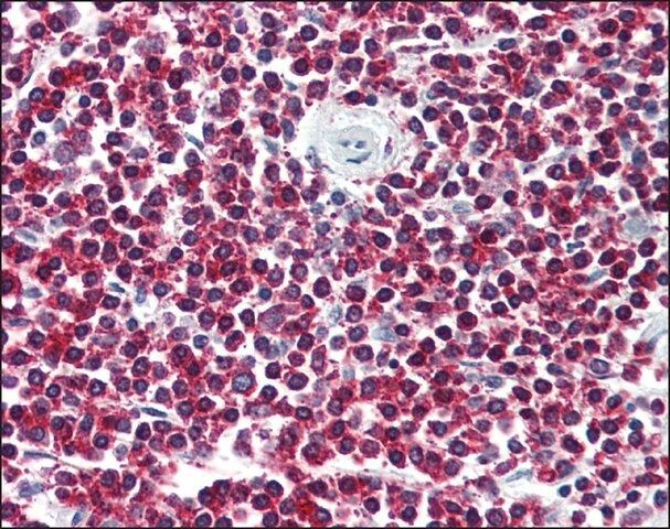 Anti-LGR6 antibody produced in rabbit