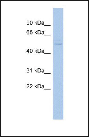 Anti-LHX3 antibody produced in rabbit