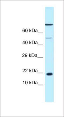 Anti-LOC683991 antibody produced in rabbit