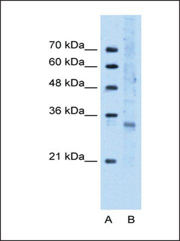 Anti-LOC730270 antibody produced in rabbit