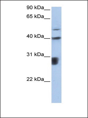 Anti-LOC652825 antibody produced in rabbit