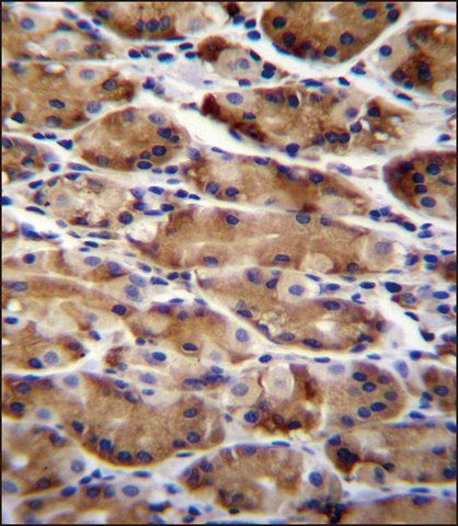 ANTI-ATG16L2 (CENTER K292) antibody produced in rabbit