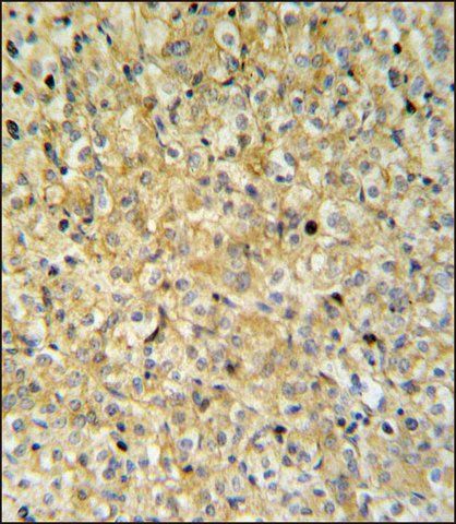 ANTI-MAPK1IP1L (CENTER) antibody produced in rabbit