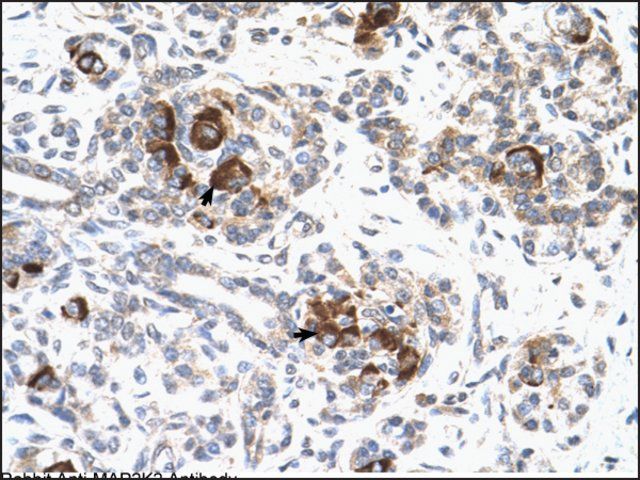 Anti-MAP2K2 antibody produced in rabbit