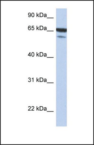 Anti-MAP3K7IP1, (N-terminal) antibody produced in rabbit