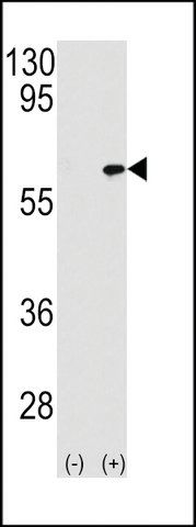 ANTI-MAP3K7IP1-S423 antibody produced in rabbit