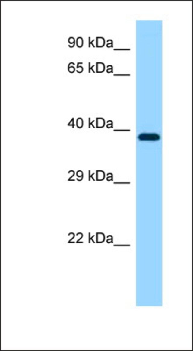 Anti-MAP2K1 antibody produced in rabbit