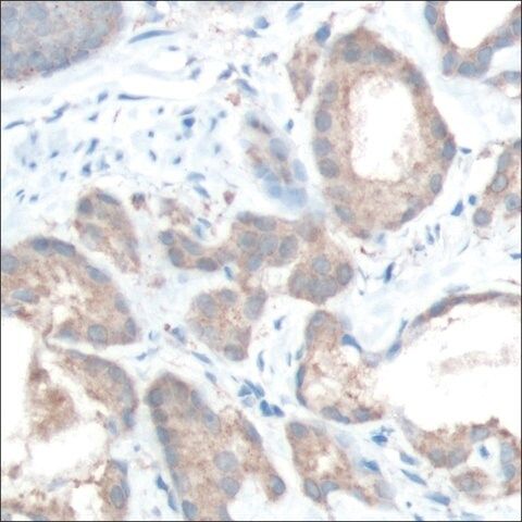 Anti-MAP4K4 antibody, Rabbit monoclonal