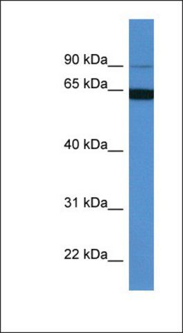 Anti-MAP6 antibody produced in rabbit