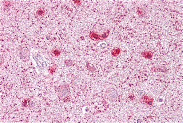 Anti-MCM3 (AB1) antibody produced in rabbit