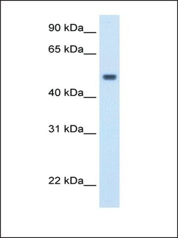 Anti-MAT1A