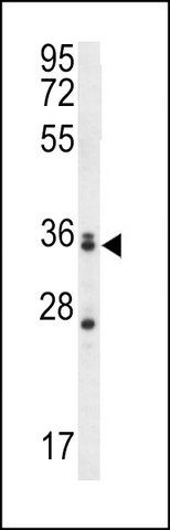 ANTI-MBNL3 (CENTER) antibody produced in rabbit