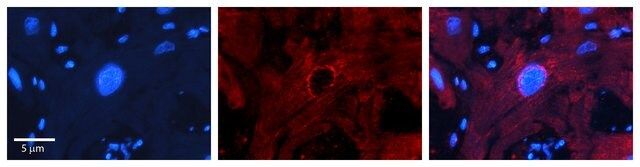 Anti-MBD2 antibody produced in rabbit