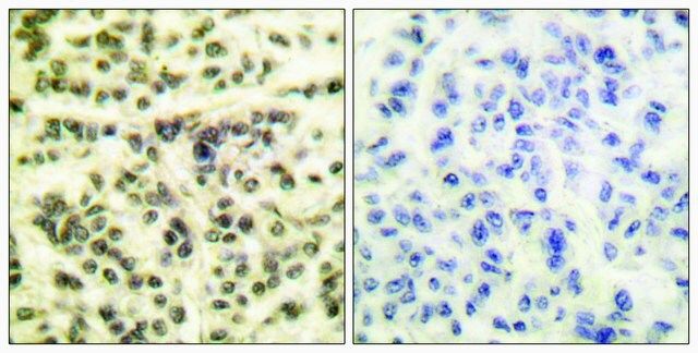 Anti-MAPKAPK2 antibody produced in rabbit