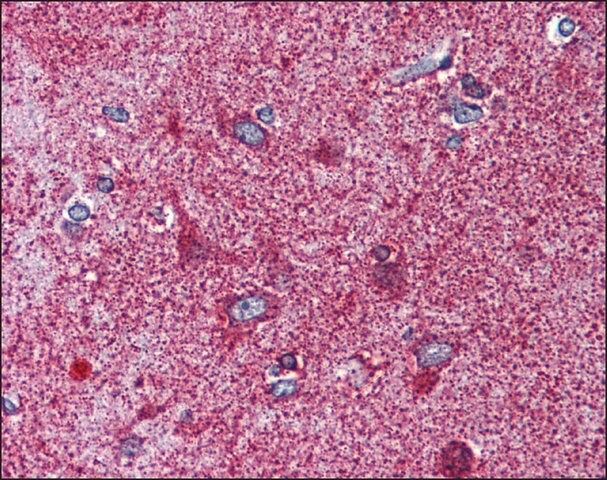 Anti-MC3R antibody produced in rabbit